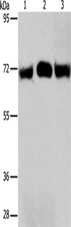 Western Blot analysis of Hela and A549 cell, Human liver cancer tissue using RPN1 Polyclonal Antibody at dilution of 1:350