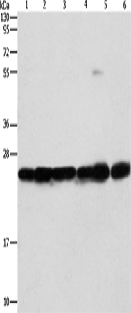 Western Blot analysis of Mouse liver and brain tissue, 293T, A549, A431 and PC3 cell using SIGMAR1 Polyclonal Antibody at dilution of 1:310