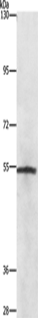 Western Blot analysis of Lovo cell using NEK2 Polyclonal Antibody at dilution of 1:727