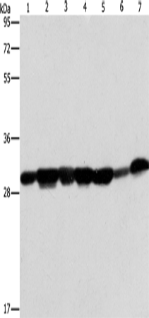 Western Blot analysis of Human placenta tissue and A549 cell, Mouse brain tissue and hepG2 cell, Raji cell and Human fetal liver tissue, hela cell using AK2 Polyclonal Antibody at dilution of 1:300