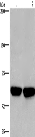 Western Blot analysis of Hela and PC3 cell using PFKP Polyclonal Antibody at dilution of 1:500