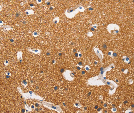 Immunohistochemistry of paraffin-embedded Human brain tissue using HK2 Polyclonal Antibody at dilution 1:40