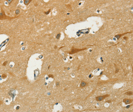 Immunohistochemistry of paraffin-embedded Human brain  using KLC1 Polyclonal Antibody at dilution of 1:40