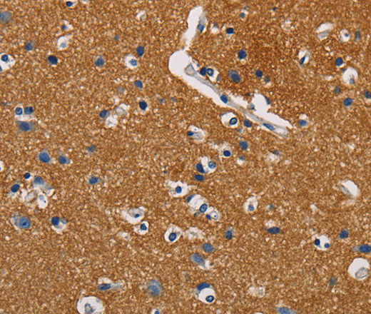 Immunohistochemistry of paraffin-embedded Human brain using GPM6A Polyclonal Antibody at dilution of 1:40