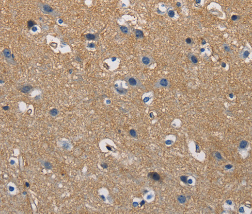 Immunohistochemistry of paraffin-embedded Human brain tissue using GSTA2 Polyclonal Antibody at dilution 1:50