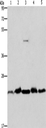 Western Blot analysis of Mouse spleen and Human fetal liver tissue, hela cell and Mouse testis tissue, A431 cell using THOC7 Polyclonal Antibody at dilution of 1:500