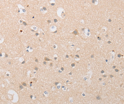 Immunohistochemistry of paraffin-embedded Human brain  tissue using ATG9A Polyclonal Antibody at dilution 1:40