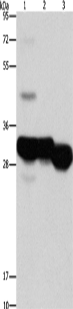 Western Blot analysis of Mouse liver and kidney tissue, Human fetal liver tissue using KHK Polyclonal Antibody at dilution of 1:1250