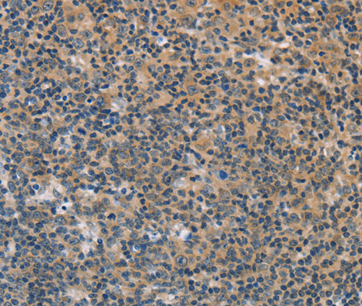 Immunohistochemistry of paraffin-embedded Human tonsil  using FXYD1 Polyclonal Antibody at dilution of 1:60