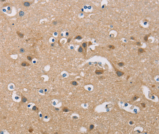 Immunohistochemistry of paraffin-embedded Human brain  using FXYD1 Polyclonal Antibody at dilution of 1:60