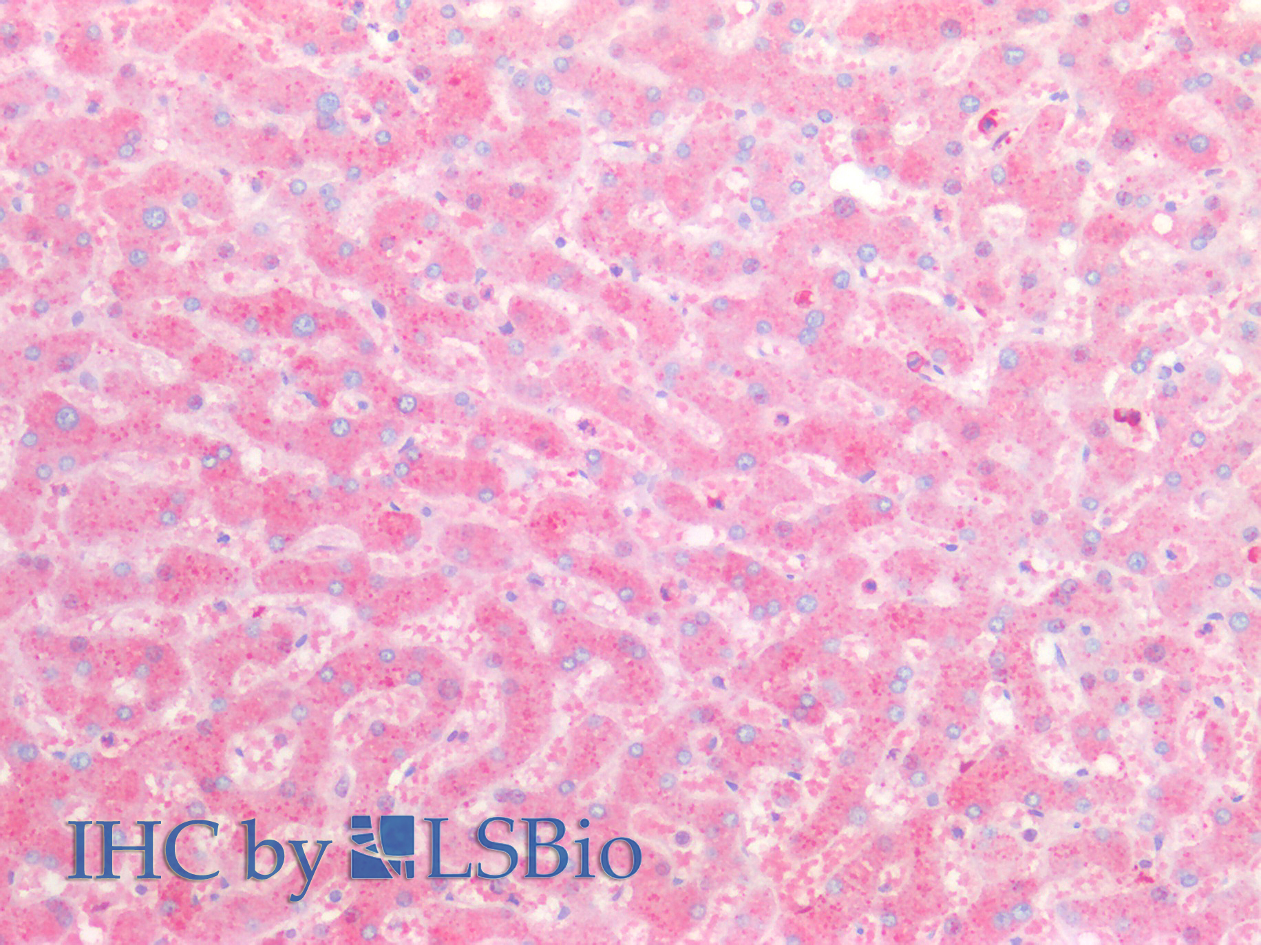 Immunohistochemistry of paraffin-embedded Human liver tissue using ORM2 Polyclonal Antibody at dilution of 1:100.