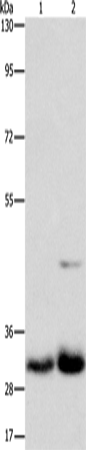 Western Blot analysis of Lovo and PC3 cell using MPG Polyclonal Antibody at dilution of 1:950