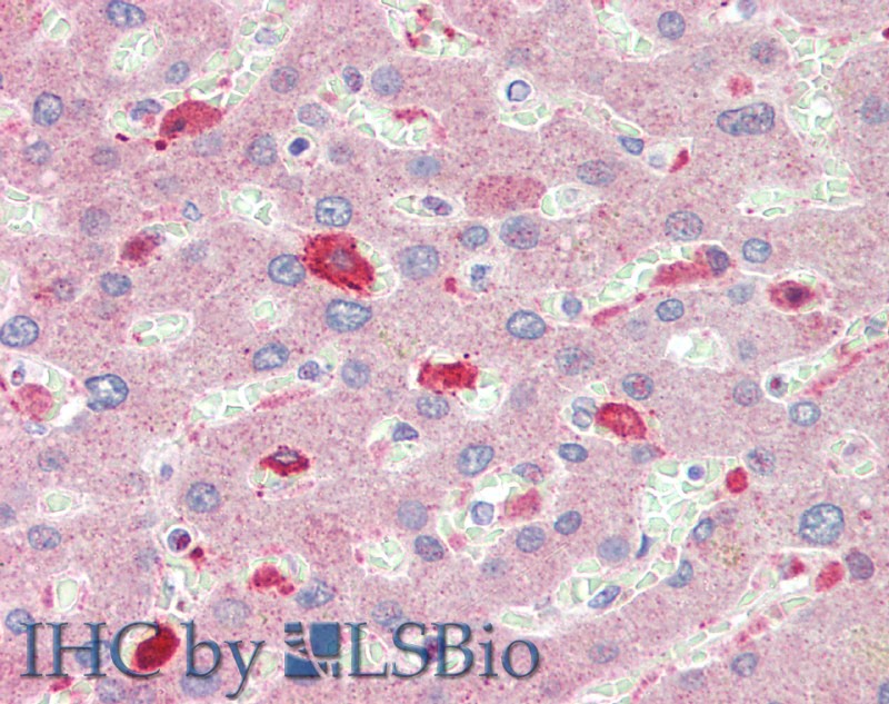 Immunohistochemistry of paraffin-embedded Liver tissue using BCAT1 Polyclonal Antibody at dilution of 1:100.