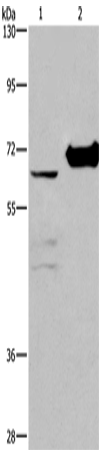 Western Blot analysis of 231 cell and Mouse kidney tissue using CHDH Polyclonal Antibody at dilution of 1:400