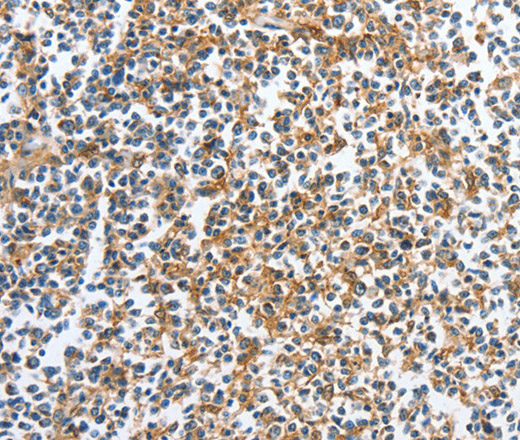 Immunohistochemistry of paraffin-embedded Human tonsil tissue using CKAP2 Polyclonal Antibody at dilution 1:70