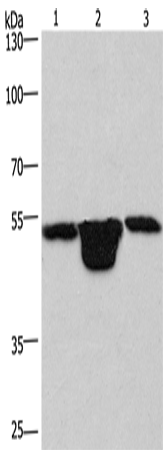 Western Blot analysis of Hela cell,  Mouse muscle and kidney tissue using PLEKHO1 Polyclonal Antibody at dilution of 1:200