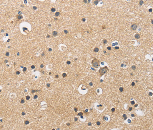 Immunohistochemistry of paraffin-embedded Human brain  using CKMT2 Polyclonal Antibody at dilution of 1:60