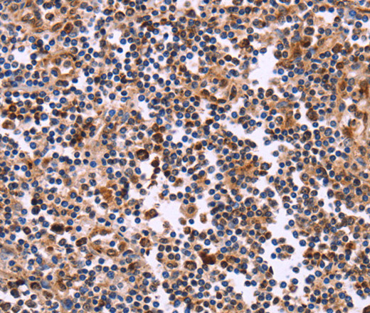 Immunohistochemistry of paraffin-embedded Human tonsil tissue using CLUAP1 Polyclonal Antibody at dilution 1:50