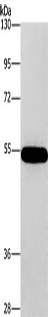 Western Blot analysis of 293T cell using CNDP1 Polyclonal Antibody at dilution of 1:320