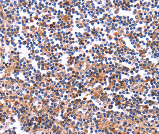 Immunohistochemistry of paraffin-embedded Human tonsil tissue using COL20A1 Polyclonal Antibody at dilution 1:40