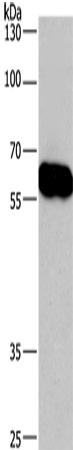 Western Blot analysis of Lovo cell  using CORO1C Polyclonal Antibody at dilution of 1:670