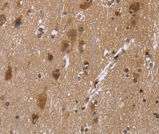 Immunohistochemistry of paraffin-embedded Human brain using c-Rel Polyclonal Antibody at dilution of 1:30