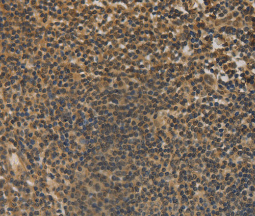 Immunohistochemistry of paraffin-embedded Human tonsil tissue using DACH1 Polyclonal Antibody at dilution 1:50