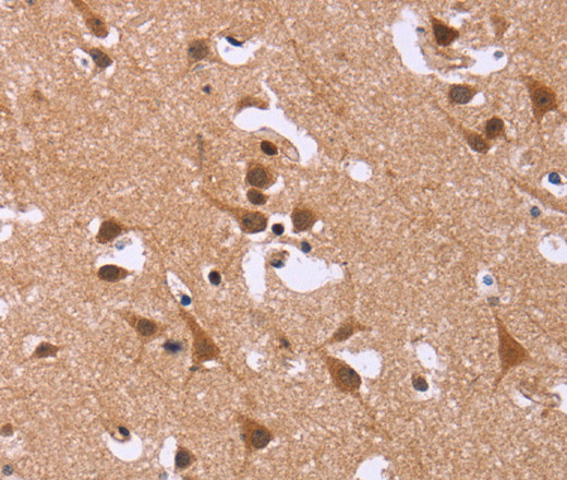 Immunohistochemistry of paraffin-embedded Human brain  tissue using DCBLD2 Polyclonal Antibody at dilution 1:50