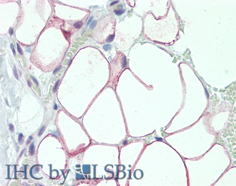 Immunohistochemistry of paraffin-embedded Adipose Tissue using DCBLD2 Polyclonal Antibody at dilution of 1:50.