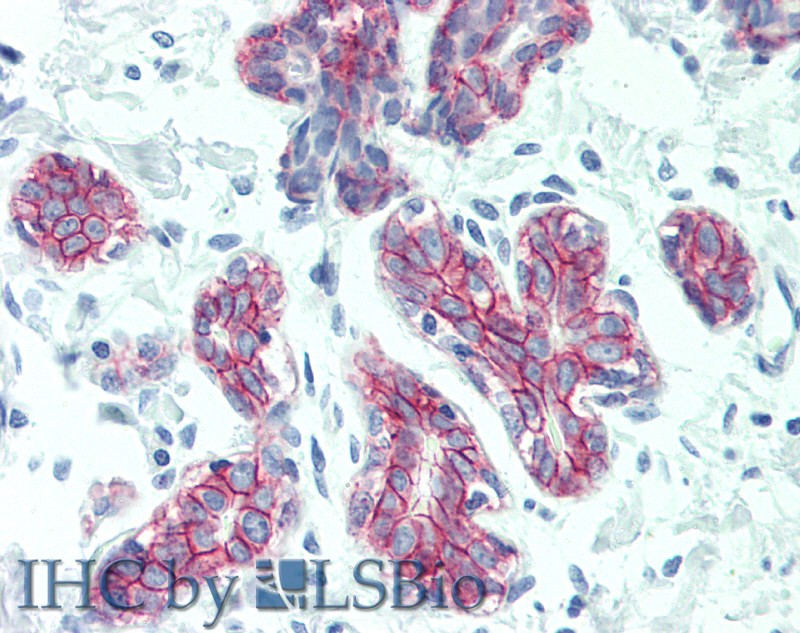 Immunohistochemistry of paraffin-embedded Breast tissue using DSG2 Polyclonal Antibody at dilution of 1:60.