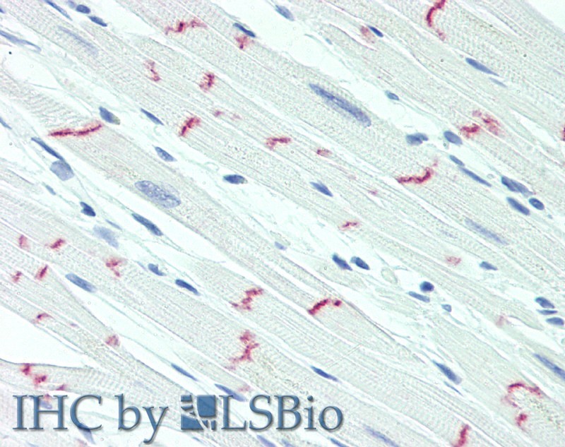 Immunohistochemistry of paraffin-embedded Heart tissue using DSG2 Polyclonal Antibody at dilution of 1:60.