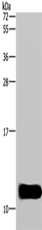 Western Blot analysis of Mouse brain tissue using DYNLL1 Polyclonal Antibody at dilution of 1:600