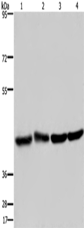 Western Blot analysis of Human fetal liver and brain tissue, 293T and Hela cell using DRG1 Polyclonal Antibody at dilution of 1:350