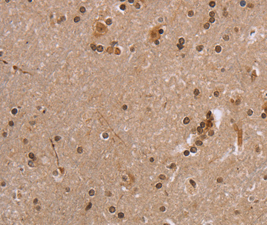 Immunohistochemistry of paraffin-embedded Human brain  tissue using EIF3H Polyclonal Antibody at dilution 1:40