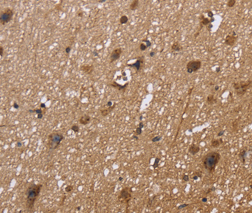 Immunohistochemistry of paraffin-embedded Human brain  tissue using EXTL3 Polyclonal Antibody at dilution 1:30