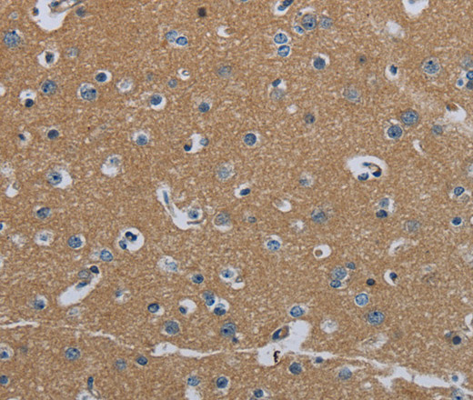 Immunohistochemistry of paraffin-embedded Human brain  tissue using FAAH Polyclonal Antibody at dilution 1:40