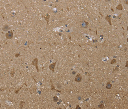 Immunohistochemistry of paraffin-embedded Human brain tissue using PTK2B Polyclonal Antibody at dilution 1:30