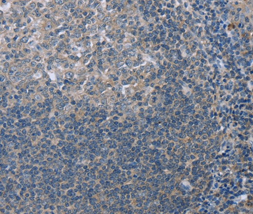 Immunohistochemistry of paraffin-embedded Human tonsil tissue using FAR2 Polyclonal Antibody at dilution 1:40