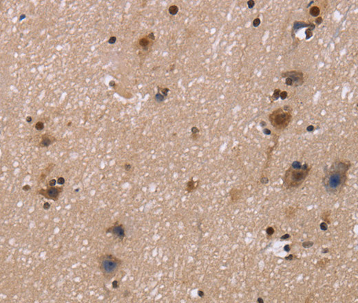 Immunohistochemistry of paraffin-embedded Human brain  tissue using FASTKD5 Polyclonal Antibody at dilution 1:40