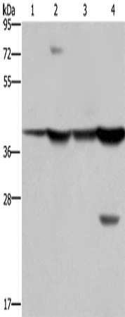 Western Blot analysis of Mouse stomach and Human fetal liver tissue, MCF-7 cell and Mouse liver tissue using FBP1 Polyclonal Antibody at dilution of 1:850