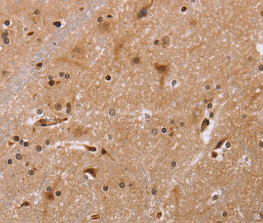 Immunohistochemistry of paraffin-embedded Human brain  tissue using FBP2 Polyclonal Antibody at dilution 1:40