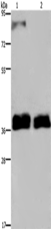 Western Blot analysis of 231 and A172 cell using FETUB Polyclonal Antibody at dilution of 1:700