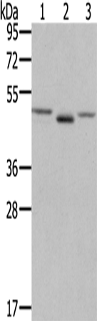 Western Blot analysis of NIH/3T3 cell and Human placenta tissue, lovo cell using FGFRL1 Polyclonal Antibody at dilution of 1:400