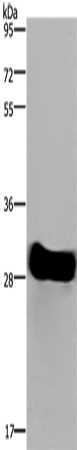 Western Blot analysis of Mouse heart tissue using FHL2 Polyclonal Antibody at dilution of 1:1900