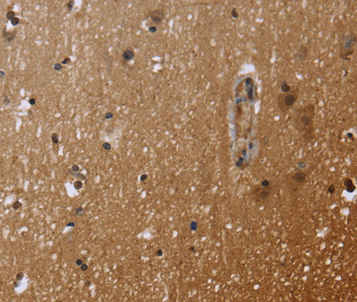 Immunohistochemistry of paraffin-embedded Human brain  using FHL3 Polyclonal Antibody at dilution of 1:40