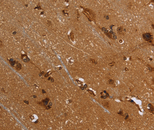 Immunohistochemistry of paraffin-embedded Human brain  using FLNA Polyclonal Antibody at dilution of 1:40