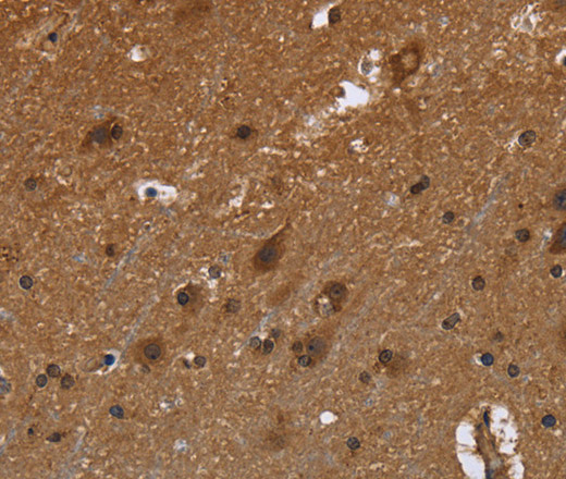 Immunohistochemistry of paraffin-embedded Human brain  using FRK Polyclonal Antibody at dilution of 1:50