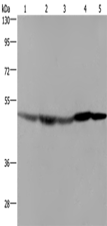 Western Blot analysis of Hela cell, Mouse liver, brain and heart tissue, RAW264.7 cell using FH Polyclonal Antibody at dilution of 1:600