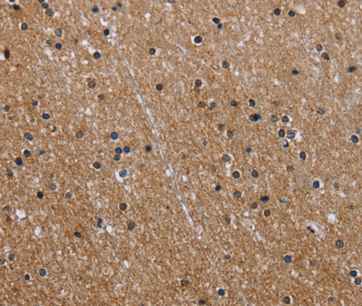 Immunohistochemistry of paraffin-embedded Human brain  using GAB2 Polyclonal Antibody at dilution of 1:40