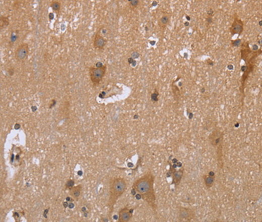 Immunohistochemistry of paraffin-embedded Human brain  using GABPB2 Polyclonal Antibody at dilution of 1:30